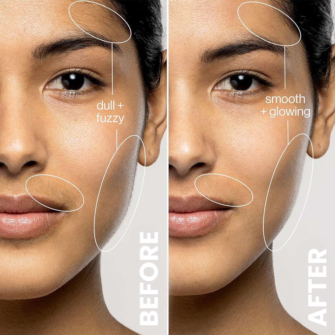 5MINSKIN ELECTRIC DERMAPLANING TOOL + FREE HAIR IDENTIFIER SPRAY - 50% OFF  VALENTINE'S DAY SALE