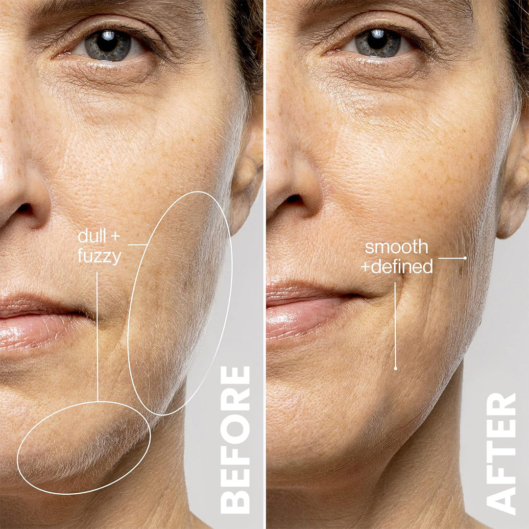 3x New Derma Blade Replacements / 3 month supply ($7.95/each)